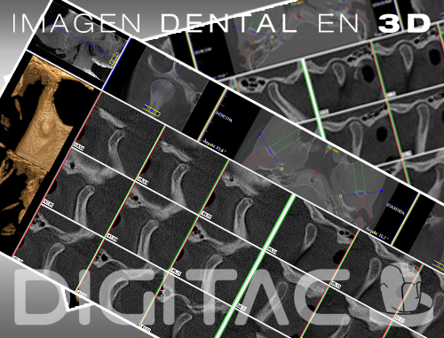 ATM Digitac Dental