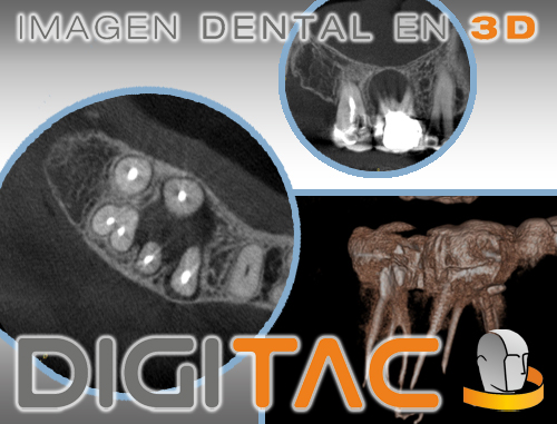 EndoScan Digitac Dental