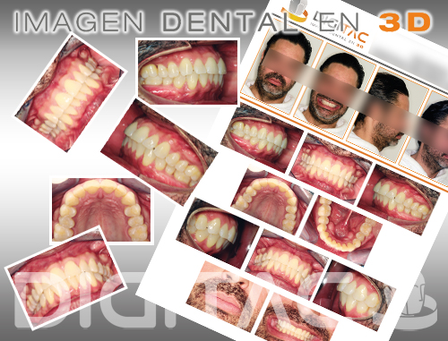 Fotografía clínica dental Digitac Dental