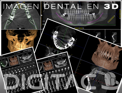 TAC - CBCT - DentaScan Digitac Dental
