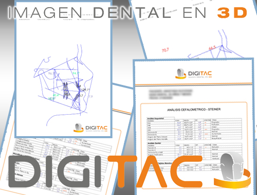 Trazados cefalométricos - Medidas ortodoncia - Digitac Dental